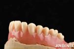 Good Elasticity Acrylic Denture Finish For Lightweight Personalized Customizatio