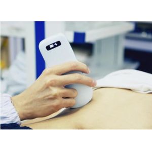 IOS Android Windows Handheld Portable Ultrasound Device Convex Linear Cardiac 3