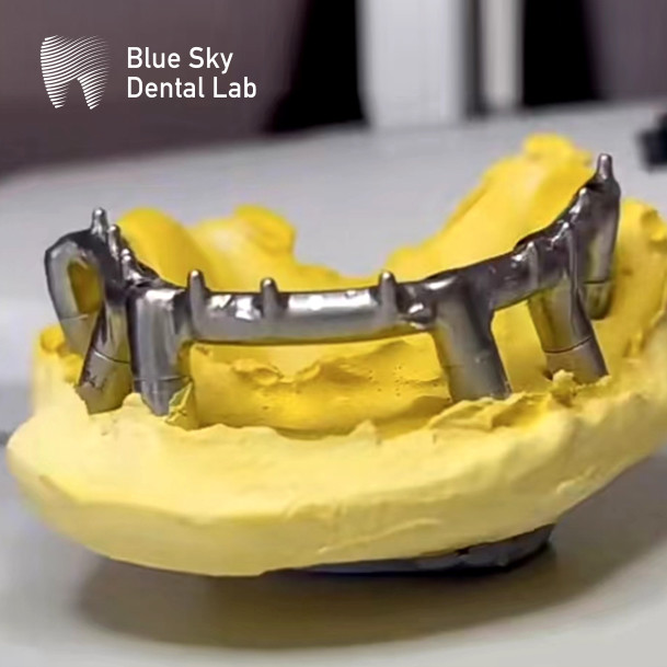Blue Sky Implant Titanium Bar Dental For Implant Dentures