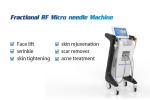 Hot sale skin rejuvenation microneedle rf machine microneedling scars removal