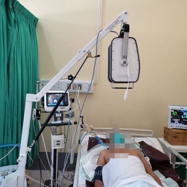 Best Sell Portable X-ray Machine Digital Digital Portable X Ray Machine