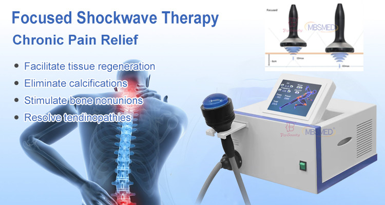 Erectile Dysfunction Focused Eswt Shockwave Therapy Machine Eliminate Calcifications