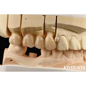 Multilayer Full Zirconia White Style With Layers High Translucency High