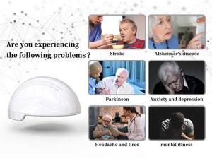 China 810nm Pbm Nervous System Photobiomodulation Helmet For Brain Therapy factory