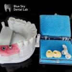 Smooth Surface Implant Cases Steam Sterilization Dental Implant Cases