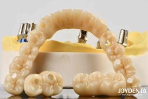 China Unmatched Accuracy Zirconia Implant Bridge Commitment To Comfort factory