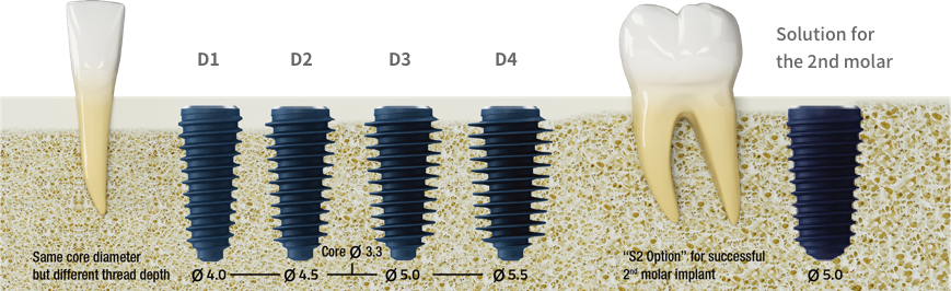 MegaGen ANYRIDGE® 14mm Dental Implant Titanium Premill Block Yenadent Holder YLB181