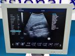 Echography Medical Ultrasound Machine 3D 4D Digital Ultrasonic Diagnostic