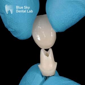 China Oral Scan Custom Zirconia Abutment High Strength Zirconia Abutments factory