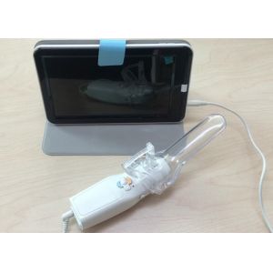 Video Output Full Digital Electronic Colposcope Gynecology Camera With User