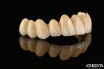 PFM Ceramic Fused To Metal Crown High Biocompatible and Corrosion Resistant