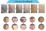 2017 Newest ND Yag Laser Beauty Equipment Laser Tattoo Removal Machine For
