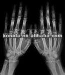 Double Sided Fuji Digital X Ray Film