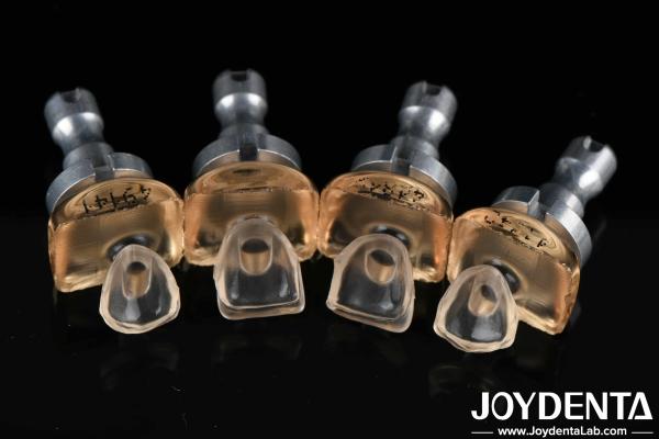 High Biocompatibility Glass Porcelain Ceramic Veneers 0.3mm-0.8mm For Teeth