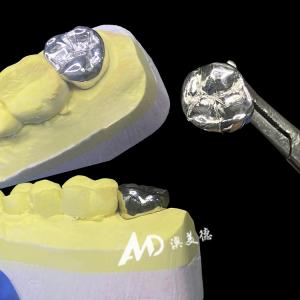Metal Titanium Crown Precision Strength and Biocompatibility for Lasting