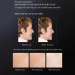 Commercial Non Invasive Skin Rejuvenation Machine , Stand Alone Skin Tightening