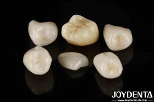 China Easy Cementation Emax Inlay Onlay Medium Strength Natural-looking Esthetics factory