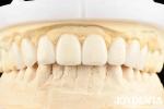 Experience the Difference with Dental's Good Elasticity and Tooth Arrangement
