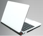 Mobile Ultrasound Machine Digital Laptop Ultrasound Scanner with 100 Frames