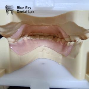 China Resin Valplast Flexible Partial Dentures Before And After Valplast Partial Denture factory