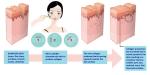 Professional Derme Roller 1.5mm Micro Needle Roller Dermaroller Derma Roller