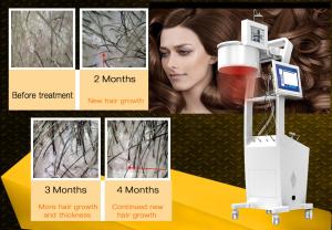 China 650nm Laser Hair Growth Machine Scalp Treatment Regrowth Salon Equipment factory