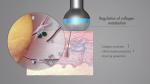 Beauty Salon Ultrasound Treatment Machine LDM Facial Skin Tightening