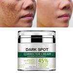 Face Black Freckle Acne Fade Dark Spot Removing Corrector Whitening Cream