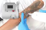 DPL Professional Q Switched Nd Yag 1064nm Carbon Peel Eyebrow Tattoo Removal