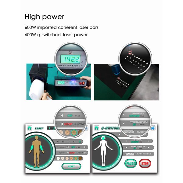 Portable Q Switched 532nm Soprano Ice Laser Machine