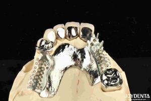 China Alloying Metal Dental Framework Removable Wearable For Dental Practitioners factory