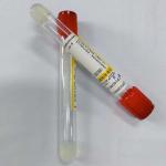 5ml Clot Activator Tube Orange Red Cap Serum Collecting Test