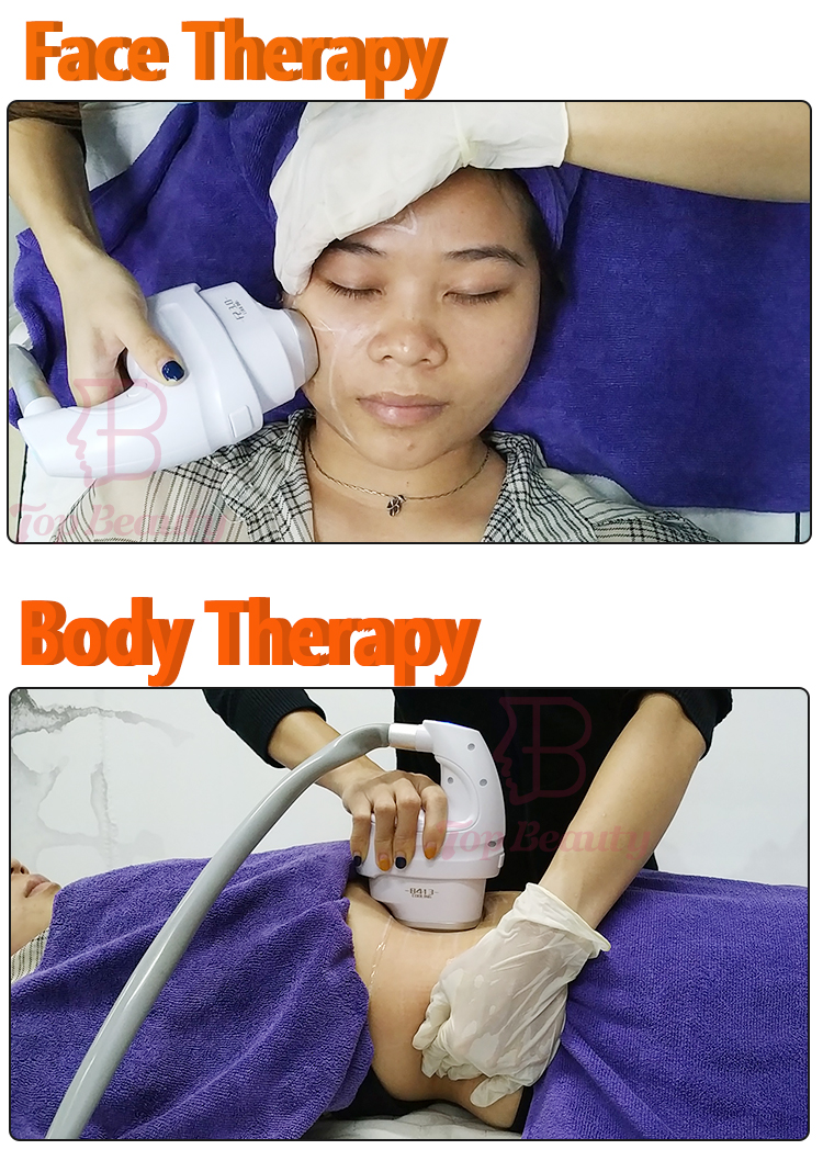 Painless 5D Ice HIFU Skin Tightening Anti Wrinkle Device