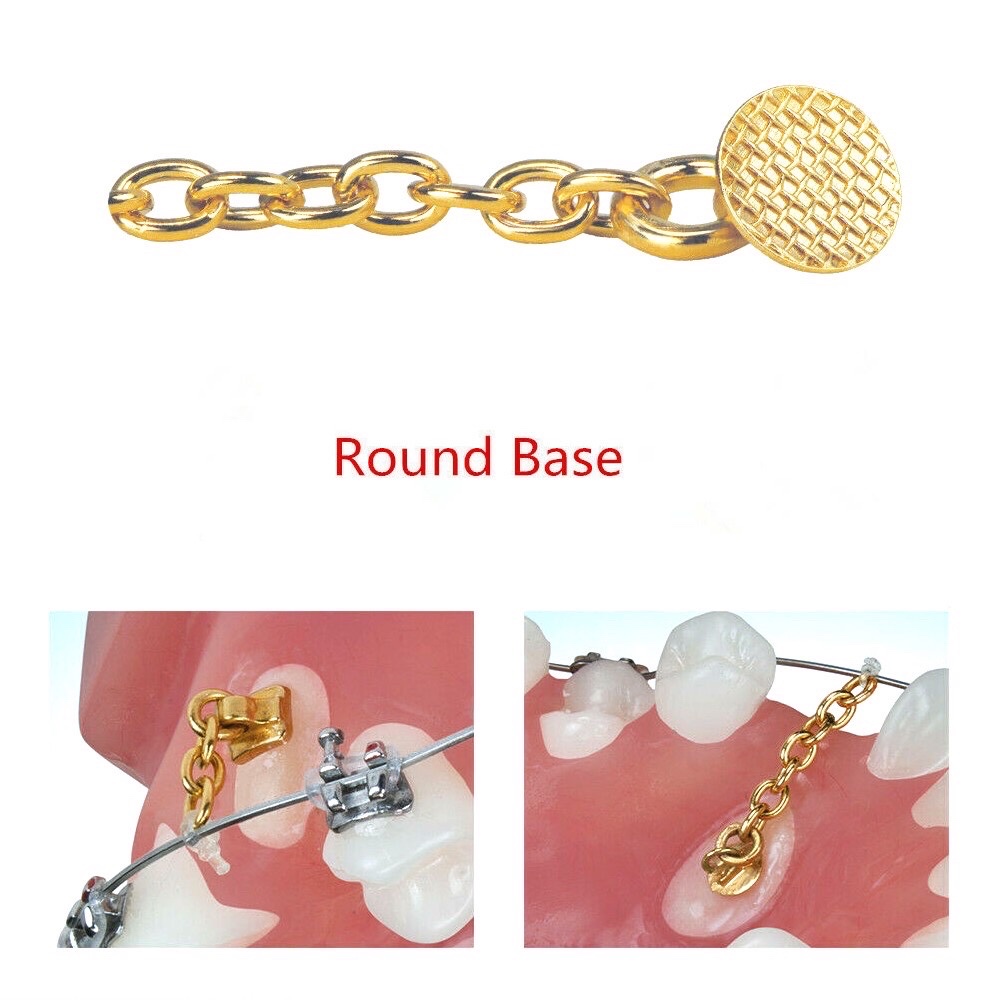MFDS Safety Standard Class II Dental Orthodontic Lingual Button Chain for Optimal Comfort in Orthodontic Treatment