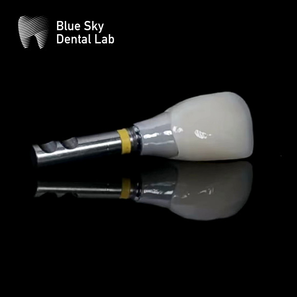Blue Sky Dental Implants Zirconia Abutment Precisely Milled