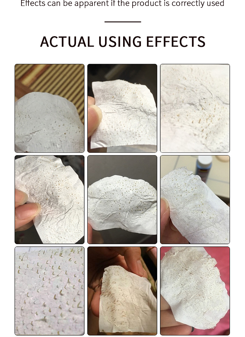 Reduce Growth Of Blackheads And Remove Oil Deep Cleaning White Nose Patch Blackhead Remover